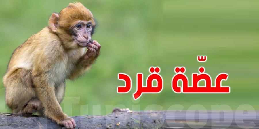 تونس: هكذا هاجم القرد طفل ال 5 سنوات - عرب بريس